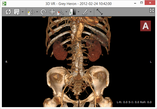 RadiAnt DICOM Viewer  характеристики