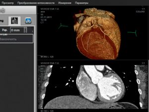 MultiVox DICOM Viewer программа