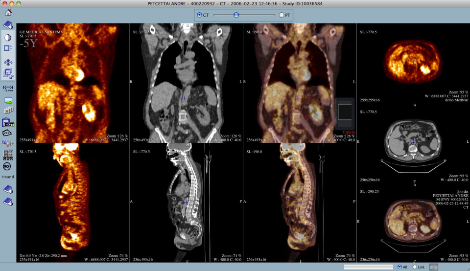 Telemis-Medical PACS отзывы