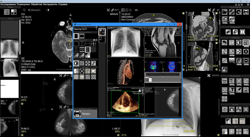Vidar Dicom Viewer характеристики