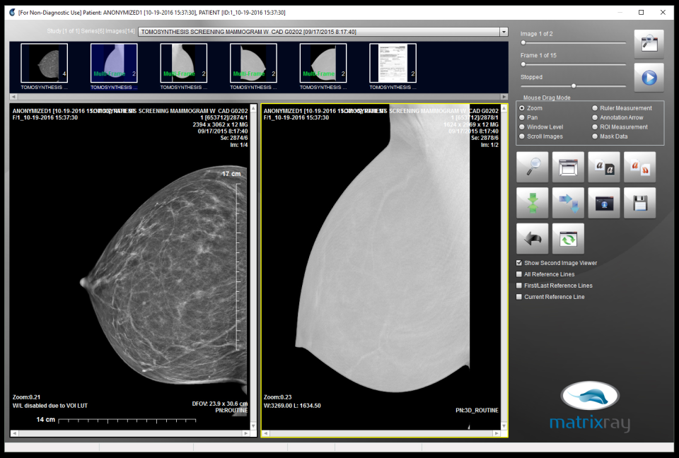 MatrixRay характеристики