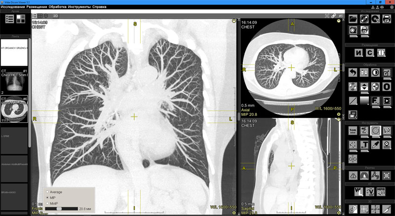 Vidar Dicom Viewer
