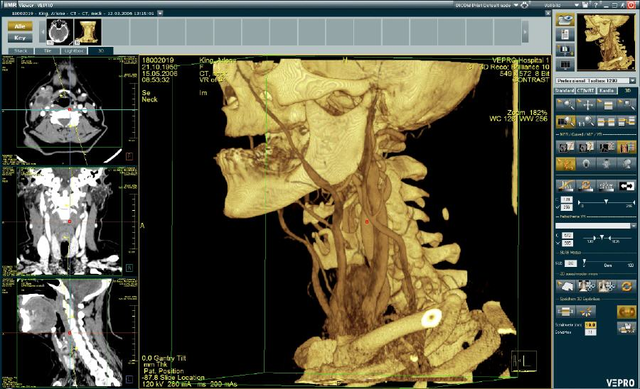 VEPRO PACS/EMR