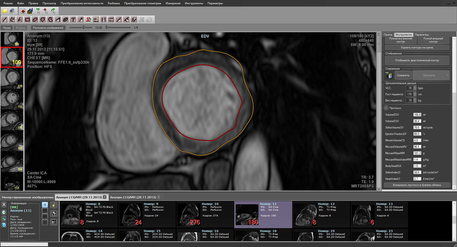 MultiVox DICOM Viewer характеристики