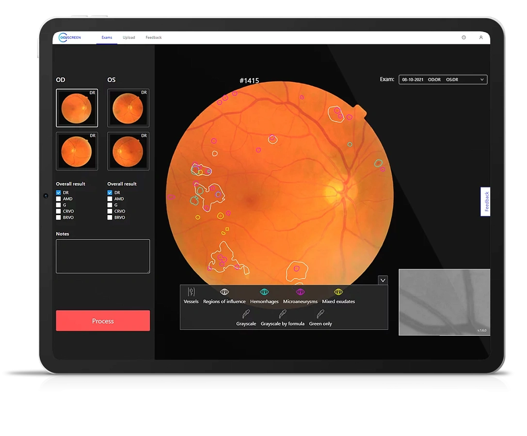 OCUSCREEN программа